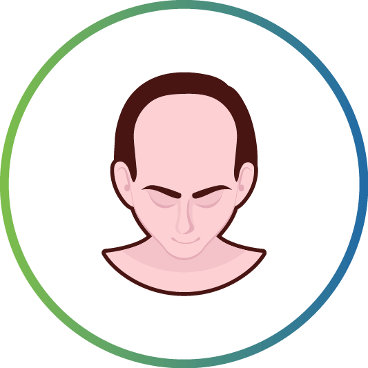 AlopeciaAreata