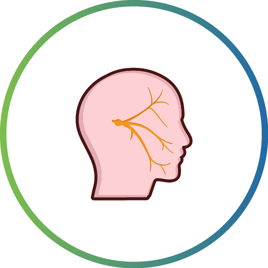 Trigeminal Neuralgia