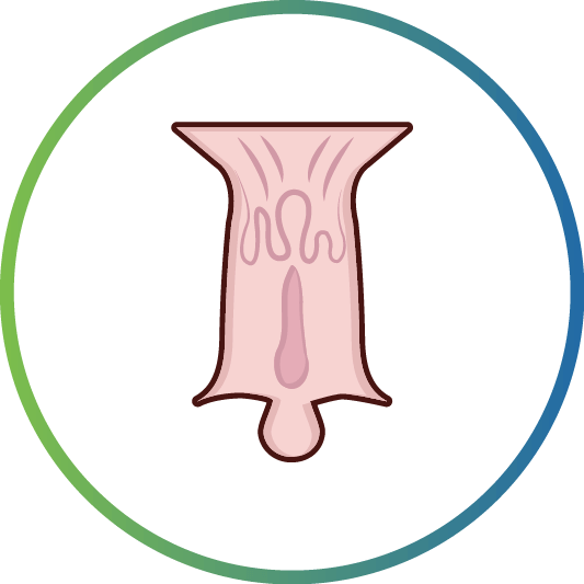 Fissure-In-Ano