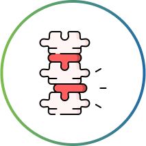 Anklosing Spondylitis