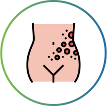 Lichen Planus