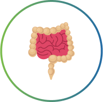 Ulcerative Colitis