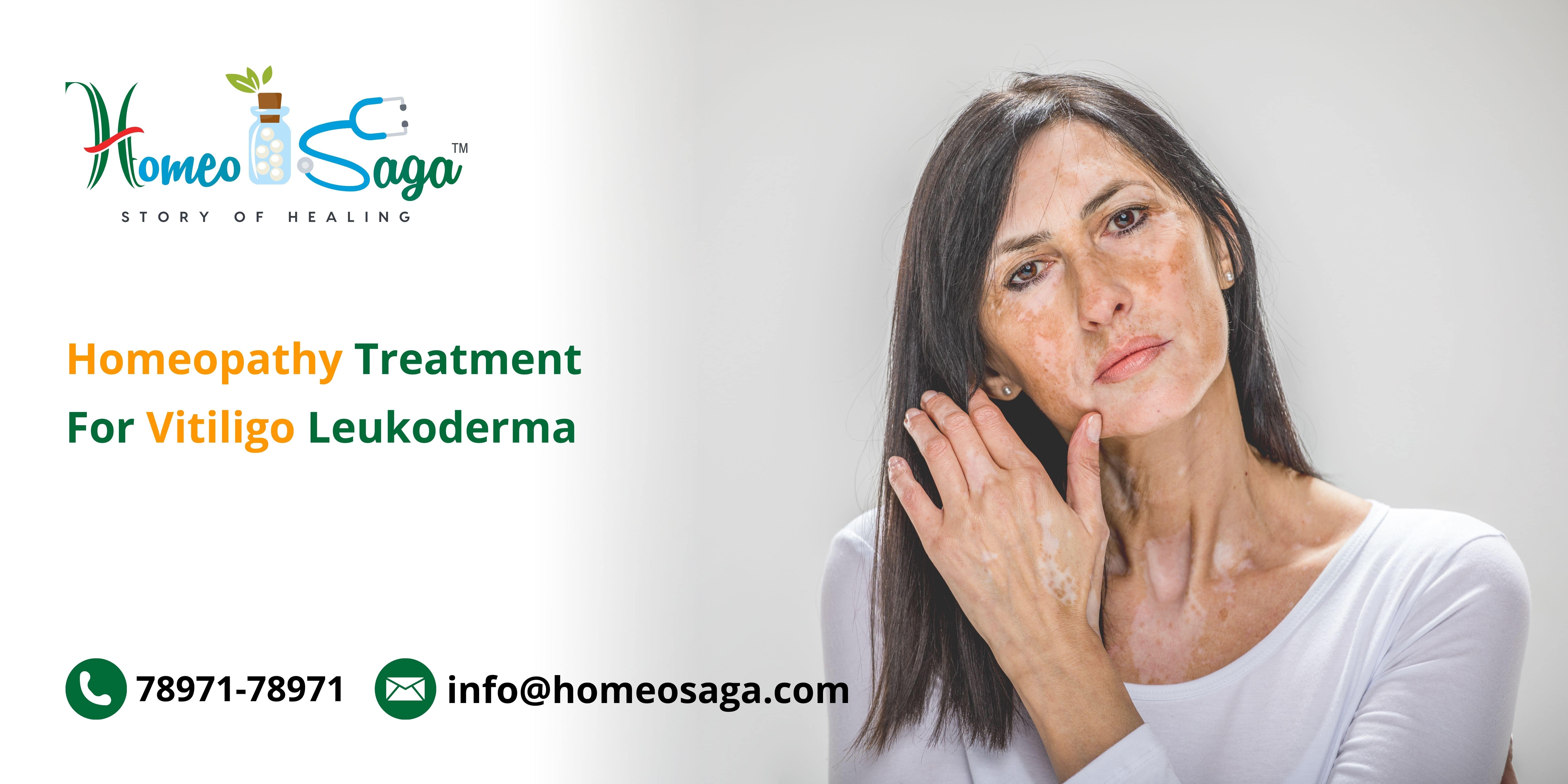 Homeopathy Treatment For Vitiligo Leukoderma