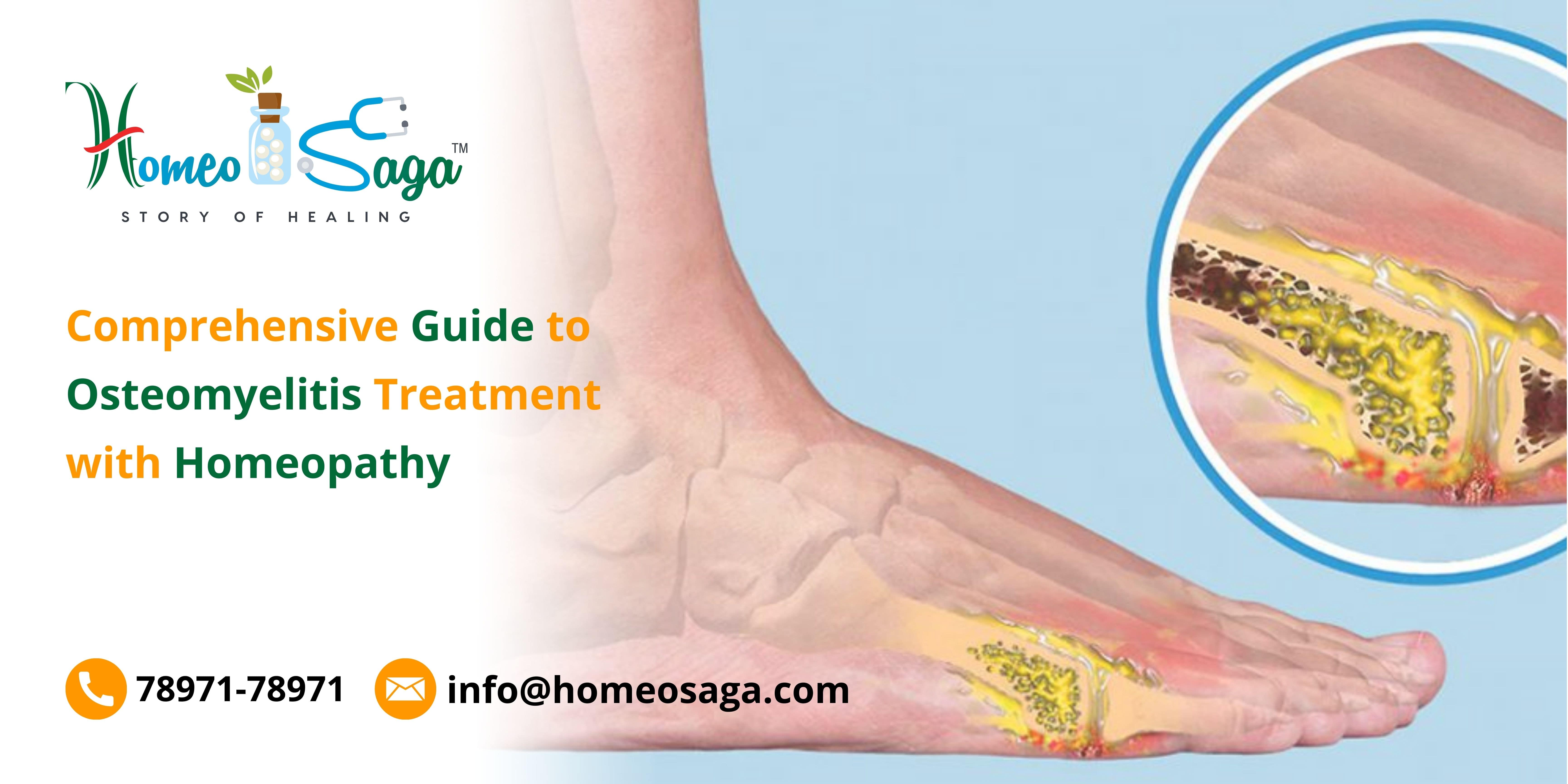 Comprehensive Guide to Osteomyelitis Treatment with Homeopathy