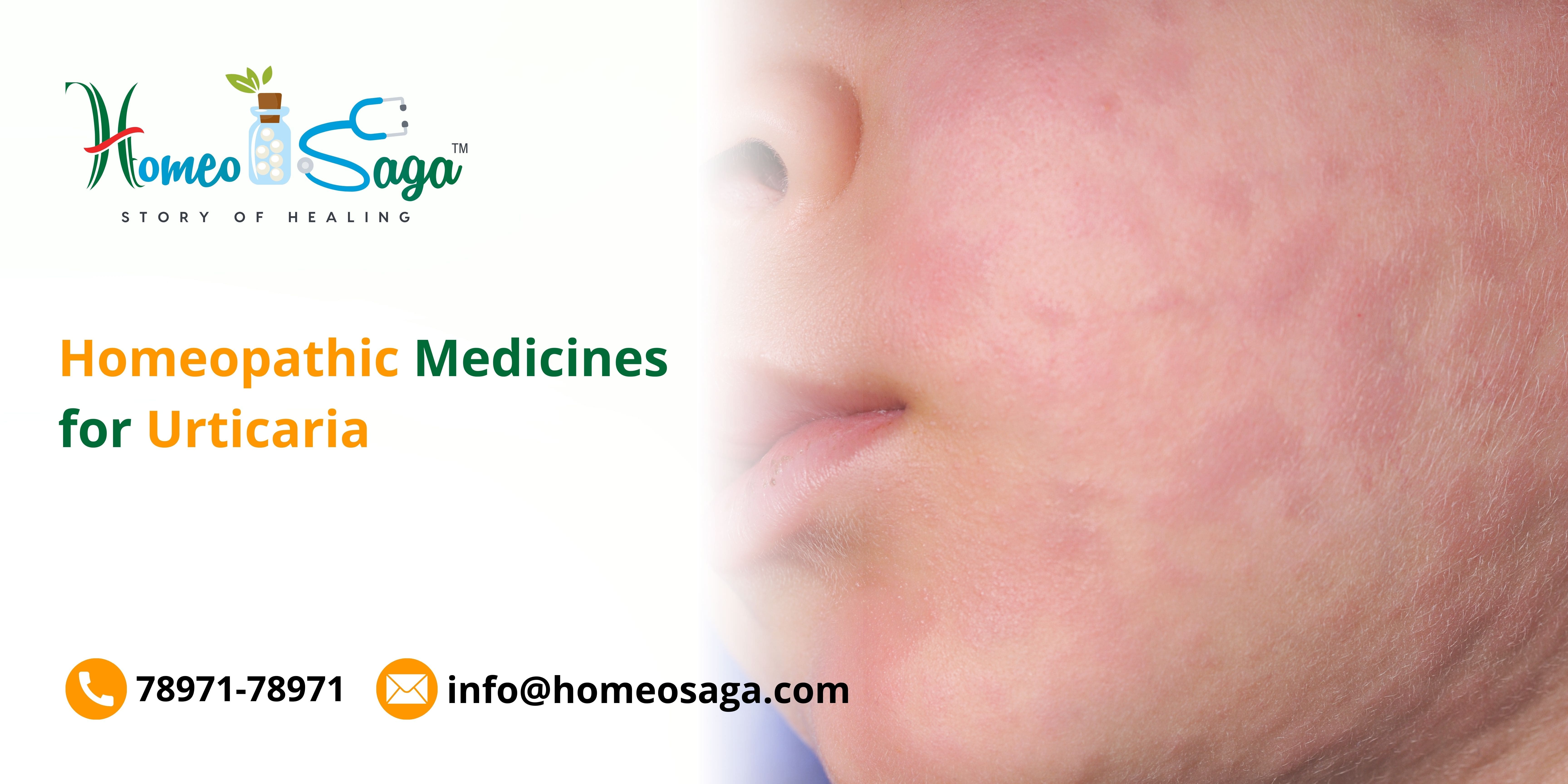 Homeopathic Medicines for Urticaria