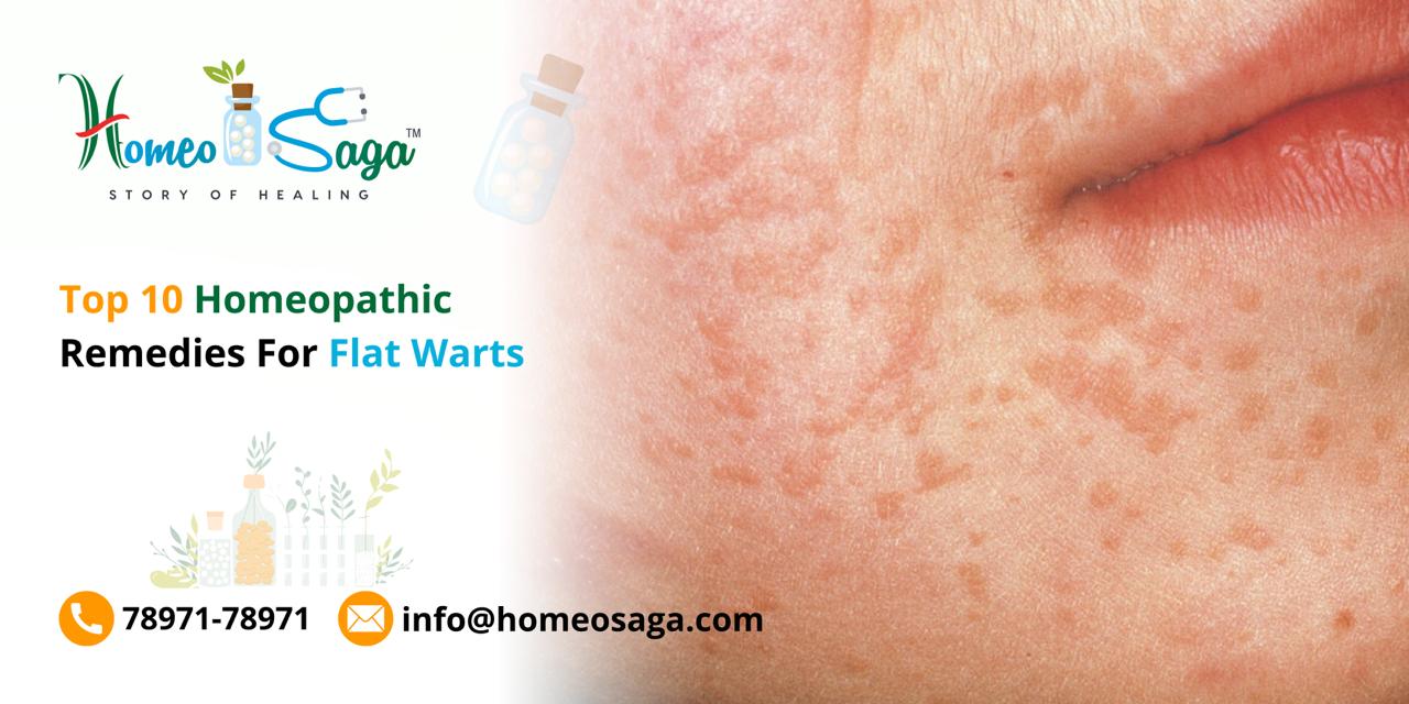 Top 10 Homeopathic Remedies For Flat Warts