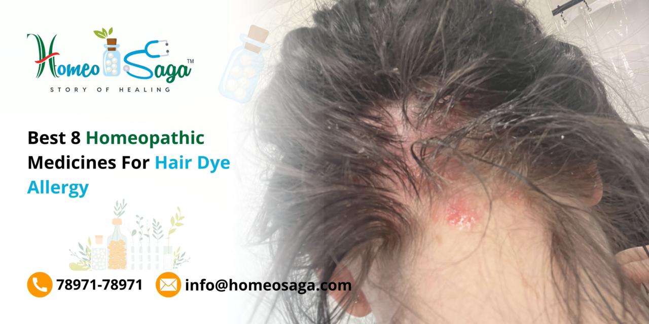 Best 8 Homeopathic Medicines For Hair Dye Allergy