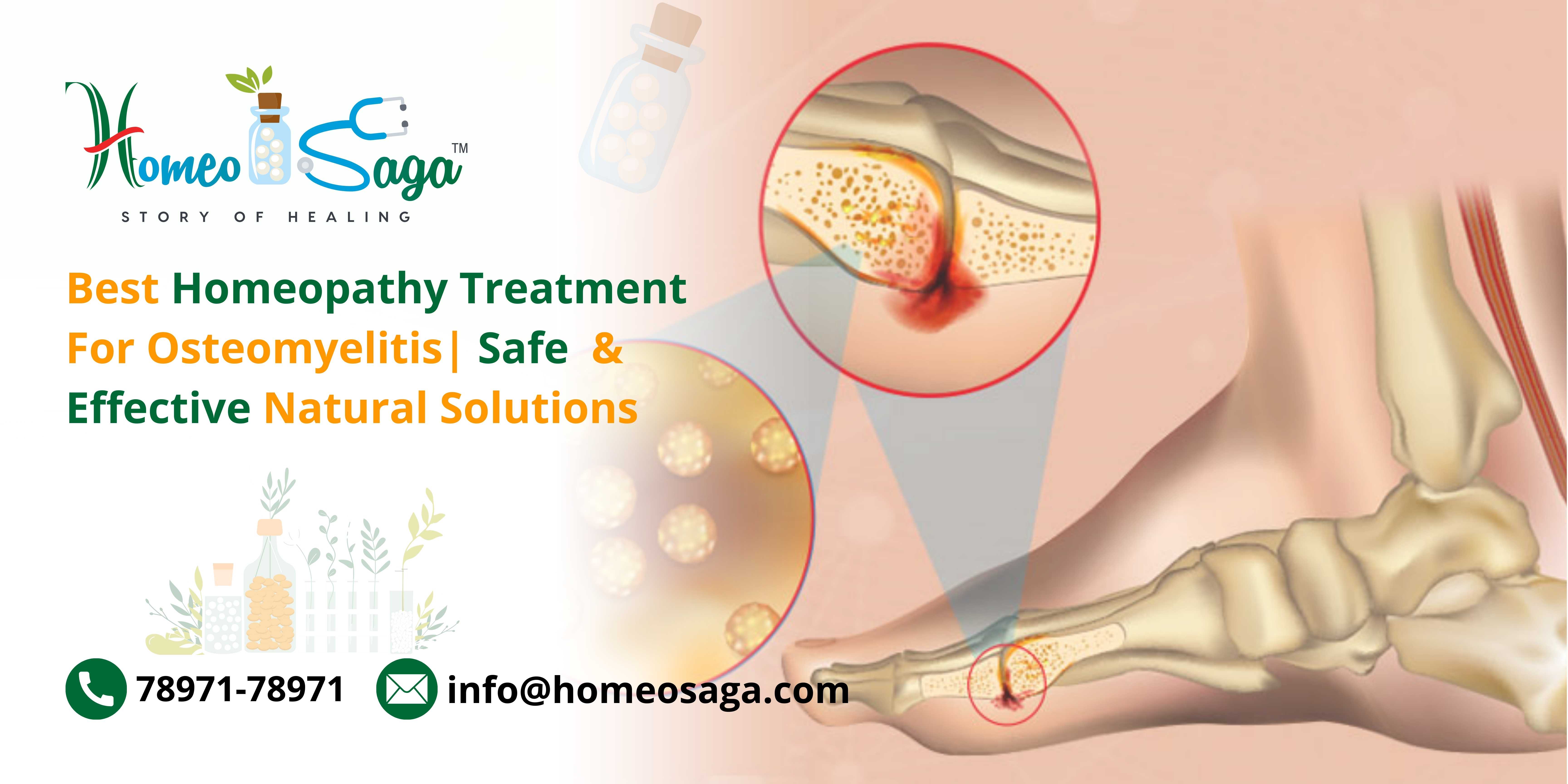 Best Homeopathy Treatment for Osteomyelitis: Safe & Effective Natural Solutions